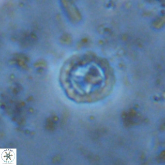 Prediscosphaera columnata VR 15133