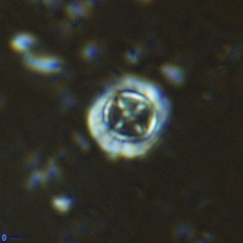 Prediscosphaera columnata VR 15144