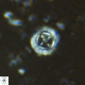 Prediscosphaera columnata VR 15144