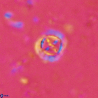 Prediscosphaera columnata VR 15146