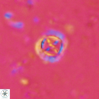 Prediscosphaera columnata VR 15146