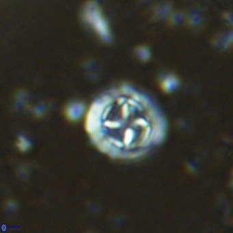 Prediscosphaera columnata VR 15147