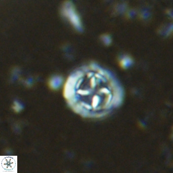 Prediscosphaera columnata VR 15147