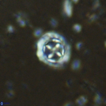 Prediscosphaera columnata VR 15149