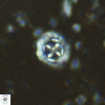Prediscosphaera columnata VR 15149
