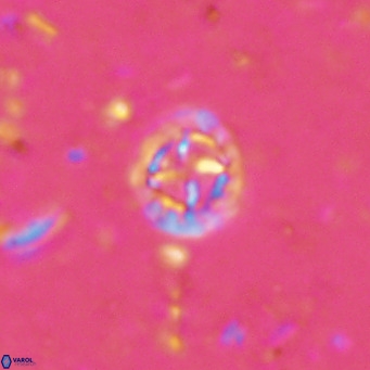 Prediscosphaera columnata VR 15141