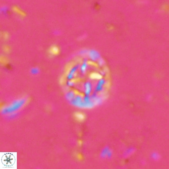 Prediscosphaera columnata VR 15141