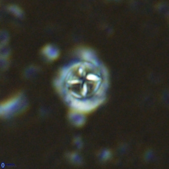 Prediscosphaera columnata VR 15142