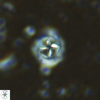 Prediscosphaera columnata VR 15142