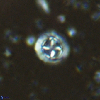 Prediscosphaera columnata VR 15155