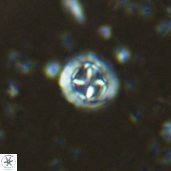 Prediscosphaera columnata VR 15155