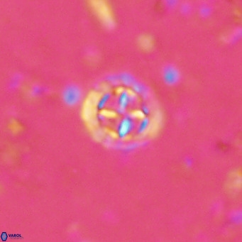 Prediscosphaera columnata VR 15156