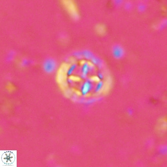 Prediscosphaera columnata VR 15156