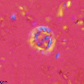 Prediscosphaera columnata VR 15158