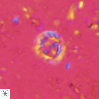 Prediscosphaera columnata VR 15158