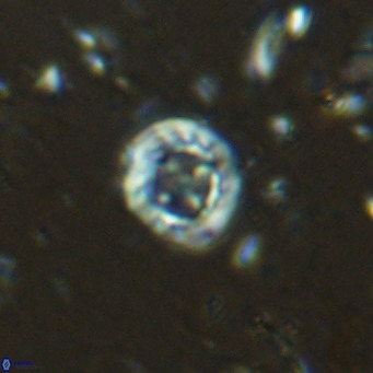 Prediscosphaera columnata VR 15159