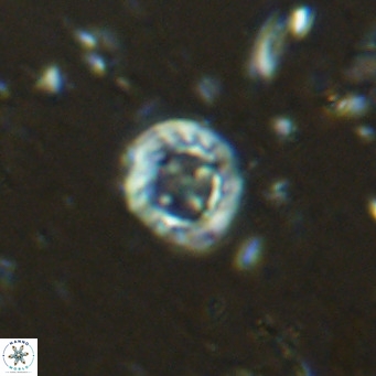 Prediscosphaera columnata VR 15159