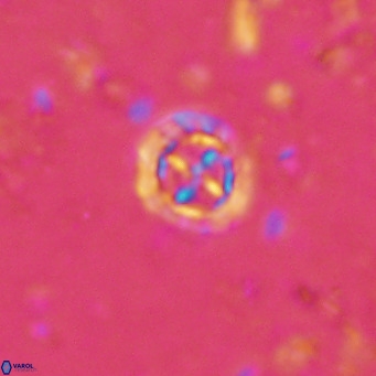 Prediscosphaera columnata VR 15150