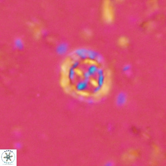 Prediscosphaera columnata VR 15150