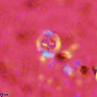 Prediscosphaera columnata VR 12214