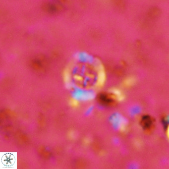 Prediscosphaera columnata VR 12214