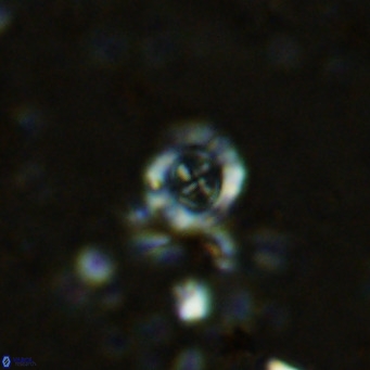 Prediscosphaera columnata VR 12215