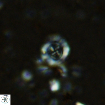Prediscosphaera columnata VR 12215