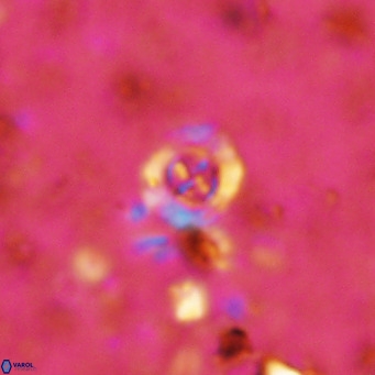 Prediscosphaera columnata VR 12216