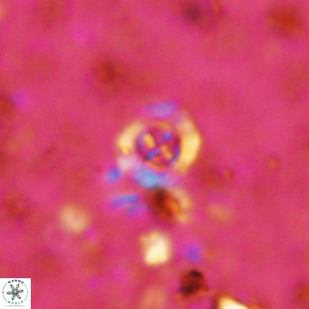 Prediscosphaera columnata VR 12216