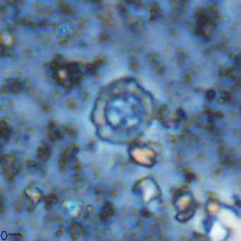 Prediscosphaera columnata VR 12229
