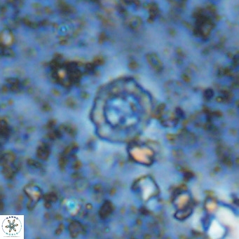 Prediscosphaera columnata VR 12229