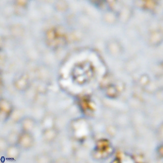 Prediscosphaera columnata VR 12221