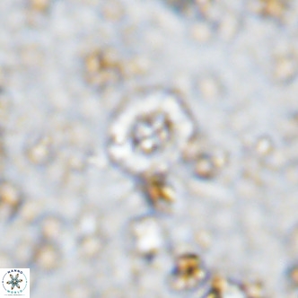 Prediscosphaera columnata VR 12221