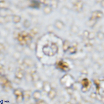 Prediscosphaera columnata VR 12223