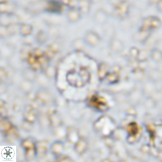 Prediscosphaera columnata VR 12223