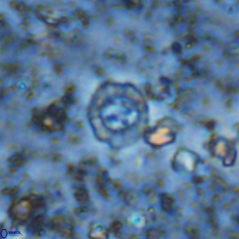 Prediscosphaera columnata VR 12230