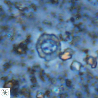 Prediscosphaera columnata VR 12230