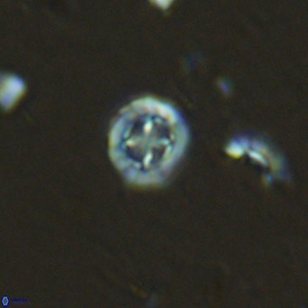 Prediscosphaera columnata VR 13917