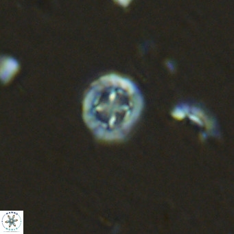 Prediscosphaera columnata VR 13917