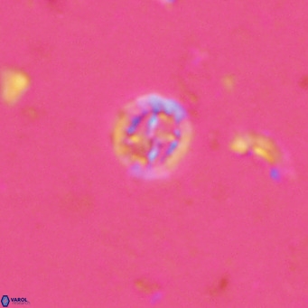 Prediscosphaera columnata VR 13918