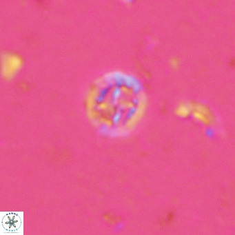 Prediscosphaera columnata VR 13918