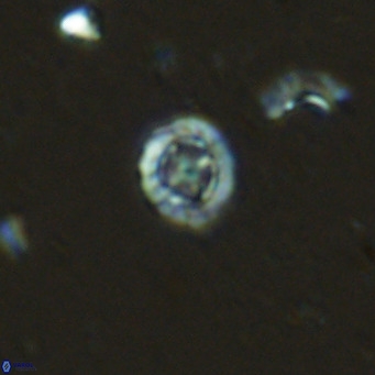 Prediscosphaera columnata VR 13919