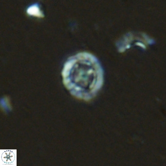 Prediscosphaera columnata VR 13919