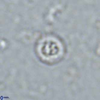 Prediscosphaera columnata VR 13925