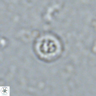 Prediscosphaera columnata VR 13925