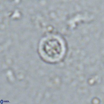 Prediscosphaera columnata VR 13926