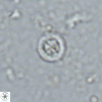 Prediscosphaera columnata VR 13926