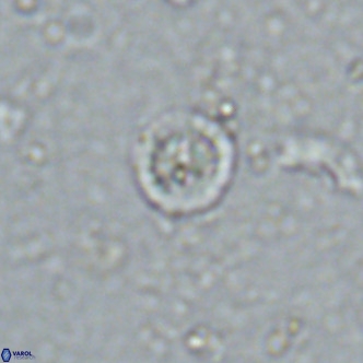 Prediscosphaera columnata VR 13927