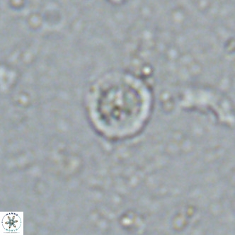 Prediscosphaera columnata VR 13927