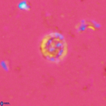Prediscosphaera columnata VR 13920